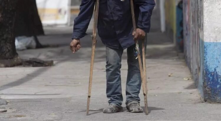 Mendigo embaucador desenmascarado en La Paz: usaba muletas para fingir discapacidad y pedir limosna Mendigo embaucador desenmascarado en La Paz: usaba muletas para fingir discapacidad y pedir limosna